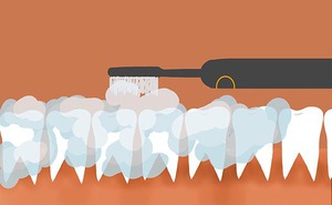 Siêng đánh răng giúp kéo dài tuổi thọ? Tránh ngay 2 thời điểm "độc hại" làm hỏng men răng