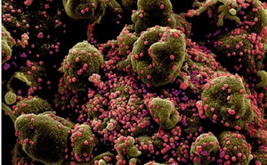 Phát hiện sinh vật đầu tiên trên thế giới chỉ ăn virus để sống