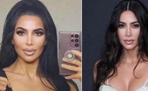 Nghiện phẫu thuật thẩm mỹ đến biến dạng,"bản sao" Kim Kardashian tử vong thương tâm