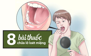 [Bài thuốc quý] Lở loét miệng gây đau đớn: Nên thử 8 cách chữa bằng thực phẩm đơn giản