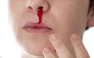 Chảy máu mũi thường xảy ra vào mùa nào?