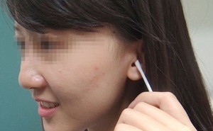 Cô gái 20 tuổi mất thính lực tạm thời do làm 1 việc mà rất nhiều người vẫn hay làm sau khi tắm