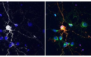 Mỹ: Nghiên cứu thuốc trị ung thư đạt được điều bất ngờ