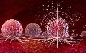 Ung thư rất ‘thích’ 2 loại thực phẩm này, chuyên gia cảnh báo: "Cần hạn chế ăn ngay lập tức"