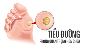 Không muốn bị tiểu đường, cần tránh những yếu tố gây bệnh ngay từ trong "trứng nước"