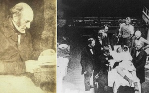 Bác sĩ phẫu thuật tai tiếng nhất thế kỷ 19: Mổ 1 nhưng chết 3, cắt chân nhanh quá xẻo nhầm cả tinh hoàn bệnh nhân