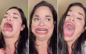 Khoe khuôn miệng rộng tới 8,89cm, cô gái "kiếm tiền như nước"