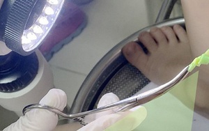 Bé gái 4 tuổi bị viêm vùng kín, giật mình thủ phạm là dây chun buộc tóc