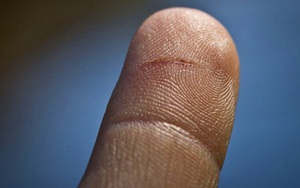Vì sao tờ giấy trắng có thể cắt đứt tay, mà lại còn đau hơn cả dao?