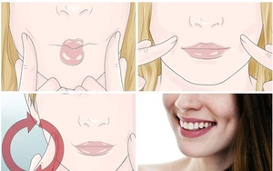 Quyết đi tạo má lúm đồng tiền vì tin rằng sẽ 'thay đổi số phận'