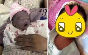 Mẹ muốn khóc khi con gái mới sinh trông như "củ khoai môn", 3 tháng sau bé có pha thay đổi ngoại hình khiến ai cũng ngỡ ngàng