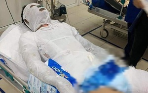 Vụ thanh niên bị đồng nghiệp cũ tạt xăng thiêu sống: Vợ trẻ nén đau thương, vay mượn khắp nơi giành giật sự sống cho chồng