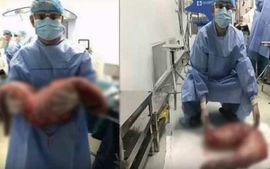 Bị táo bón bẩm sinh, anh chàng khiến các bác sĩ tá hỏa khi phẫu thuật cắt đoạn ruột chứa 13kg chất thải