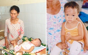 Sau 17 năm được nhận nuôi ở Mỹ, cuộc sống hiện tại của bé gái Việt mất 2 chân sau vụ nổ thương tâm khiến ai cũng phải ngạc nhiên