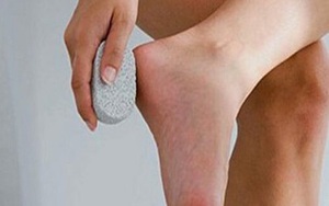 10 mẹo nhỏ giúp đánh bay những vết chai chân tay khó chịu
