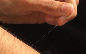 Tại sao một số lông trên cơ thể bạn có thể mọc dài tới mức vô lý