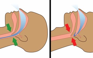 Cứ đến giữa đêm lại tỉnh giấc, nghe thì 'kinh dị' nhưng hóa ra đều có lý do cả