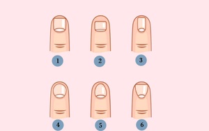 Nhìn xuống bàn tay soi kỹ móng tay của mình xem chúng thuộc loại nào sau đây để biết bạn là người linh hoạt tháo vát hay mong manh yếu đuối