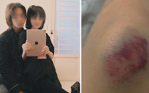 Mẫu ảnh Sài Gòn tố bị đánh đập và chửi bới vì ghen tuông, bạn trai photographer lên tiếng