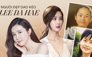 Mỹ nhân “dao kéo” thị phi nhất Kbiz Lee Da Hae: Hiện tượng 1 thời sụp đổ vì nghi án bán dâm, tình yêu bất ngờ với ca sĩ "mát xa đèn mờ"