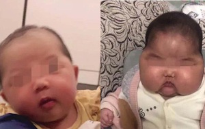 Sự cố “em bé đầu to” chấn động Trung Quốc, hàng loạt kem dưỡng da em bé bị thu hồi khiến phụ huynh hoang mang