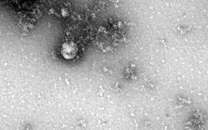 Hình ảnh hiển vi đầu tiên về biến thể mới virus SARS-CoV-2 phát hiện ở Anh