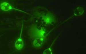 Loài sinh vật kỳ lạ có thể sống sót không cần oxy