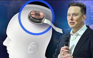 Elon Musk sắp cấy chip vào não người, giúp người liệt đặt hàng online, lướt web bằng sóng não