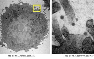 Càng nhiều người nhiễm SARS-CoV-2, virus càng có cơ hội biến chủng