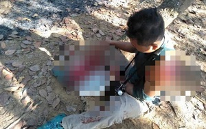 Kinh hãi người đàn ông bị bò tót húc nát vai và chân ở Đồng Nai