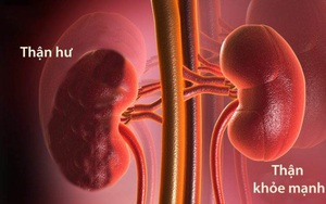Người thận yếu thường có 6 đặc điểm rất dễ nhận biết: Hãy sớm đi khám nếu bạn có cảm giác tương tự
