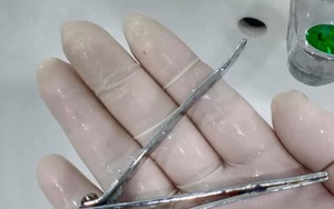 Ớn lạnh với người đàn ông ngậm chiếc bấm móng tay rồi vô tình nuốt chửng