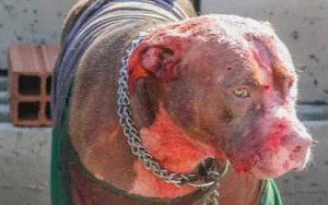 Bị 7 con chó Pitbull tấn công, người đàn ông xấu số bị cào nát mặt