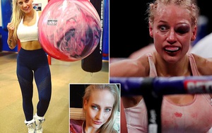 Nữ võ sĩ xinh đẹp bị đánh biến dạng mặt khi tham gia trận tranh đai thế giới