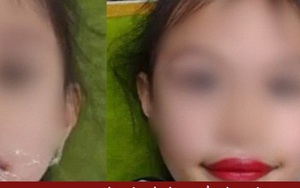 Xôn xao thẩm mỹ viện phun môi cho... bé gái 5 tuổi