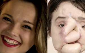 Nổ súng vào mặt tự tử nhưng bất thành, cô gái xinh đẹp khiến khuôn mặt mình bị phá huỷ và diện mạo sau 6 năm gây ngỡ ngàng