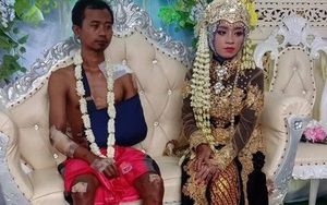 Bức ảnh chú rể mặt buồn thiu, toàn thân đầy thương tích tại đám cưới gây bão MXH, câu chuyện phía sau khiến ai cũng xúc động