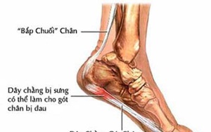 Bi đau gót chân là biểu hiện của bệnh gì? Có nguy hiểm không?