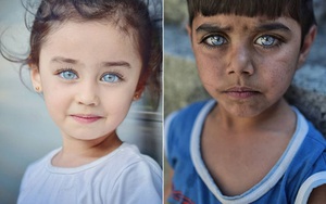Những đôi mắt đẹp tới siêu thực của trẻ em Thổ Nhĩ Kỳ qua ống kính nhiếp ảnh gia