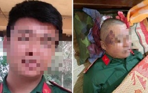 Khởi tố vụ án "Cố ý gây thương tích" liên quan vụ quân nhân tử vong ở Gia Lai
