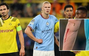 Vì sao HLV Man City vội vàng rút Haaland ra khỏi sân trong trận gặp Dortmund?