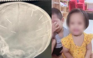 Từ vụ bé gái bị đóng 9 chiếc đinh vào đầu: Cha mẹ đừng vô tâm với con