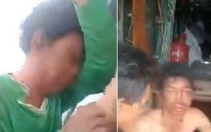 Vụ người đàn ông bị 'tra tấn' bằng kìm trên tàu biển: Vì sao chưa điều tra, xử lý nghi phạm?