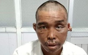 Công an nói về quy trình tiếp nhận vụ ngư dân bị hành hạ dã man