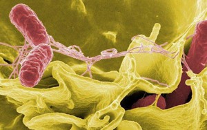 Lưu ý khi điều trị bệnh nhiễm khuẩn Salmonella