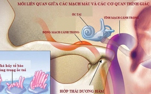 Ù tai có thể là chỉ dấu báo trước về bệnh tim mạch nguy hiểm