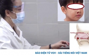 Chảy máu cam mùa đông, có nên lo lắng hay không?