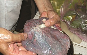 Nhau thai bà đẻ có tác dụng như thế nào theo quan niệm Đông y?