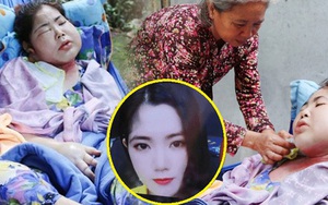 Xót cảnh cô gái trẻ nằm một chỗ, bị biến dạng khuôn mặt sau khi giấu bệnh để đi làm kiếm tiền điều trị ung thư cho cha