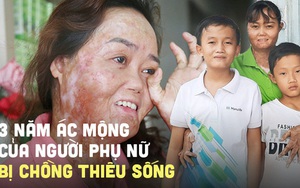 Người phụ nữ bị chồng tưới xăng thiêu sống, bỏng 92%: "3 năm qua giống như một cơn ác mộng, em đau lắm nhưng phải sống vì con"